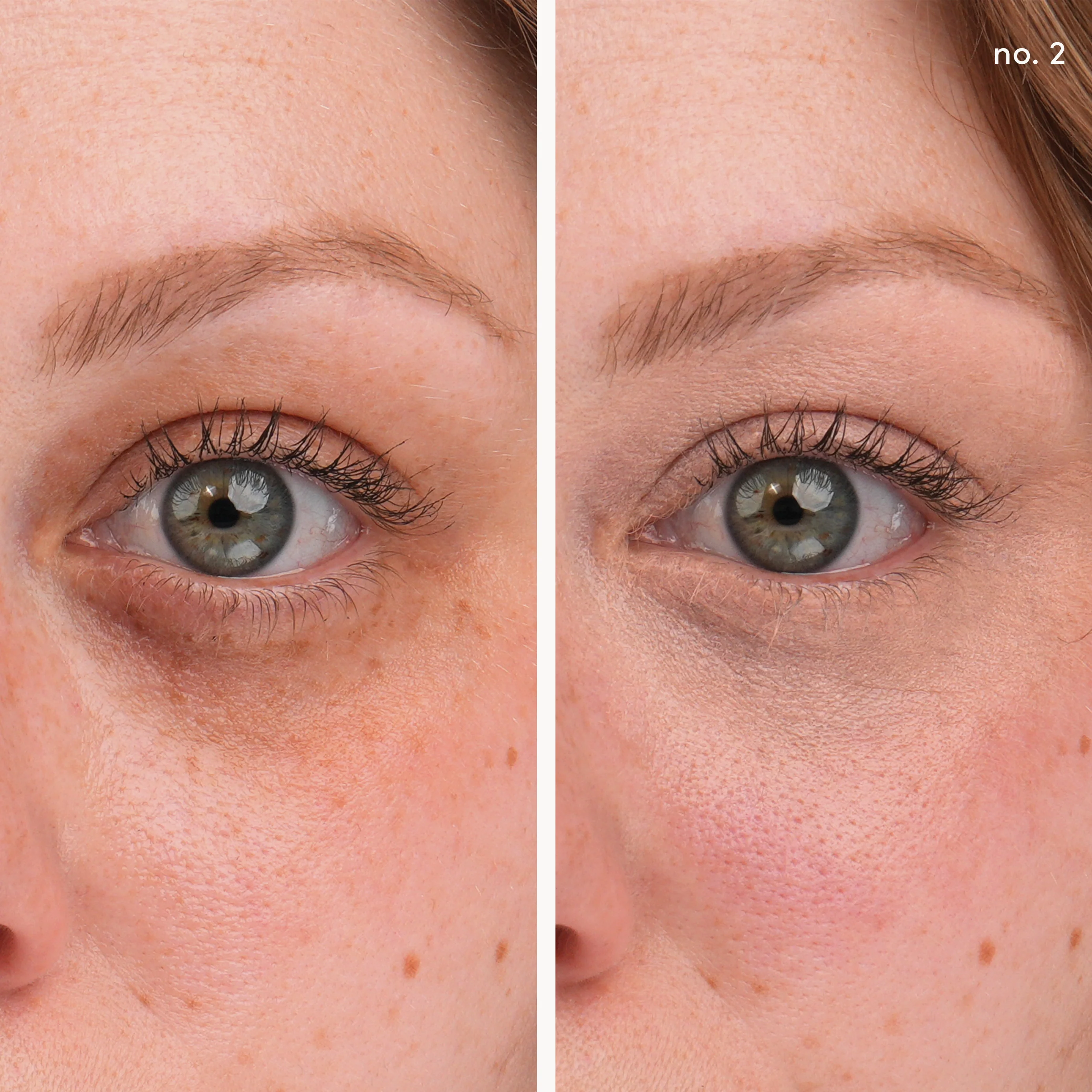 Circle\Delete® Concealer - Image 10