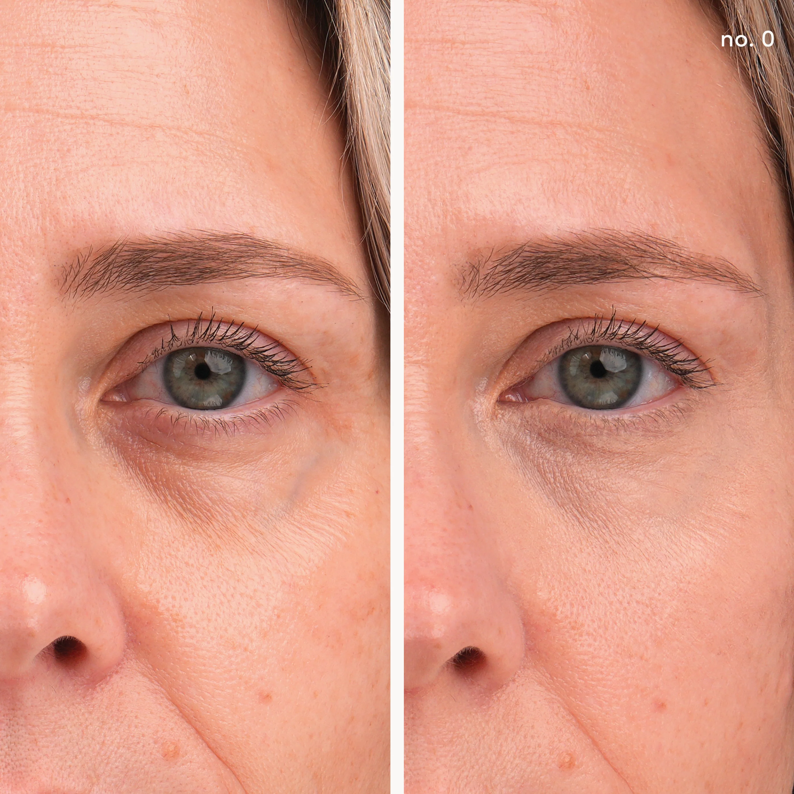 Enlighten Plus™ Under-eye Concealer - Image 13