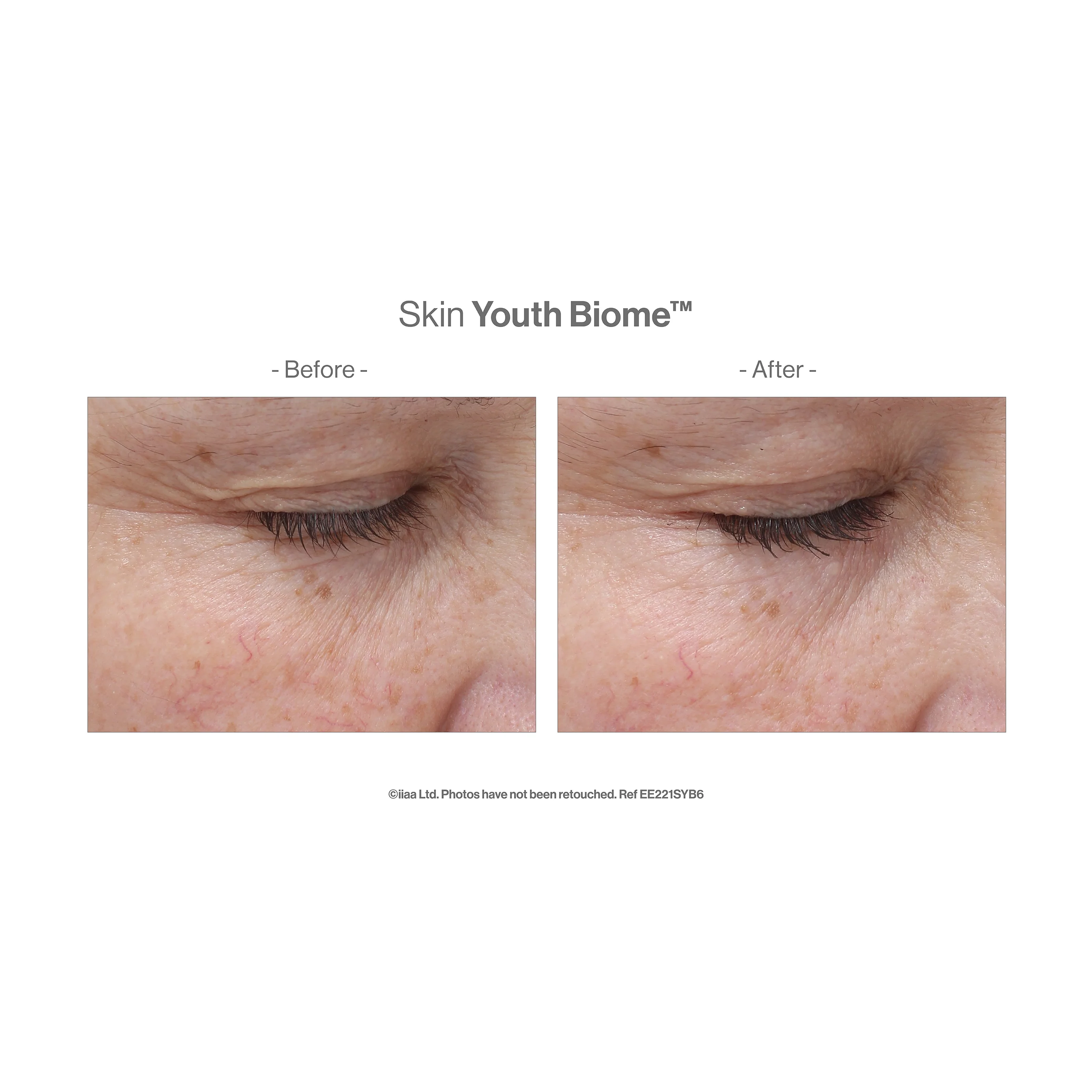 Skin Youth Biome 10 Day Discovery Pack - Image 3